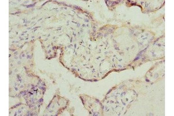 TESK2 antibody  (AA 302-571)