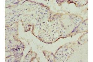 Immunohistochemistry of paraffin-embedded human placenta tissue using ABIN7150790 at dilution of 1:100 (TESK2 antibody  (AA 302-571))