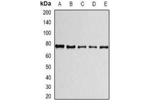 Western blot analysis of PRPF3 expression in A549 (A), HepG2 (B), THP1 (C), mouse spleen (D), mouse testis (E) whole cell lysates. (PRPF3 antibody)