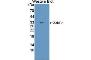 Western blot analysis of the recombinant protein. (ERBB3 antibody  (AA 709-966))