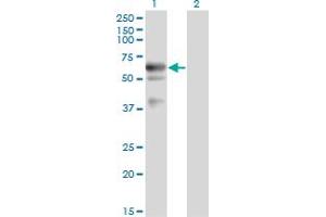 Western Blot analysis of LIPG expression in transfected 293T cell line by LIPG monoclonal antibody (M02), clone 1E11. (LIPG antibody  (AA 21-500))