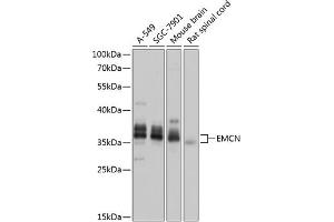 Western blot analysis of extracts of various cell lines, using EMCN antibody (ABIN6127867, ABIN6140148, ABIN6140150 and ABIN6218389) at 1:1000 dilution. (Endomucin antibody  (AA 19-135))
