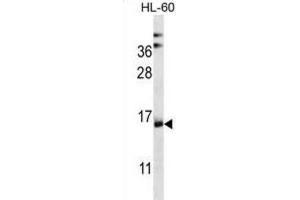 Western Blotting (WB) image for anti-NADH Dehydrogenase (Ubiquinone) 1 alpha Subcomplex, Assembly Factor 4 (NDUFAF4) antibody (ABIN2997063) (NDUFAF4 antibody)