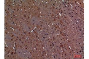 Immunohistochemistry (IHC) analysis of paraffin-embedded Rat Brain, antibody was diluted at 1:100. (CALB1 antibody  (C-Term))