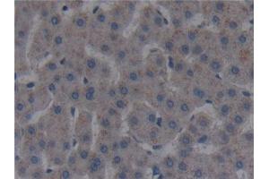 Detection of FAPa in Human Liver Tissue using Polyclonal Antibody to Fibroblast Activation Protein Alpha (FAPa) (FAP antibody  (AA 523-760))