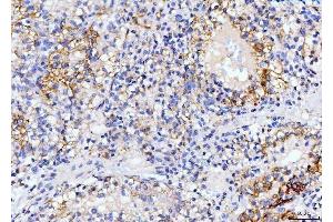 anti-Dihydroorotate Dehydrogenase (DHODH) (N-Term) antibody