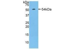 Detection of Recombinant FcgR3A, Rat using Polyclonal Antibody to Fc Fragment Of IgG Low Affinity IIIa Receptor (FcgR3A) (FCGR3A antibody  (AA 5-241))