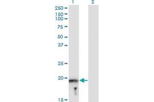 Western Blot analysis of MYLPF expression in transfected 293T cell line by MYLPF monoclonal antibody (M05), clone 3H3.