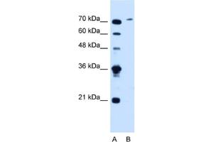 Western Blotting (WB) image for anti-Solute Carrier Organic Anion Transporter Family, Member 6A1 (SLCO6A1) antibody (ABIN2462781)