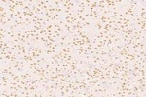 Immunohistochemistry (Paraffin-embedded Sections) (IHC (p)) image for anti-Sad1 and UNC84 Domain Containing 2 (SUN2) antibody (ABIN7075502)
