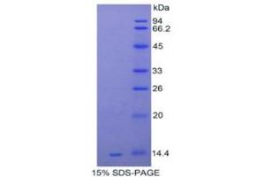 SDS-PAGE (SDS) image for Serum Amyloid A (SAA) (AA 20-122) protein (His tag) (ABIN1080798)
