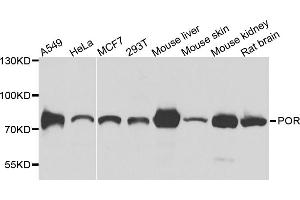 Western blot analysis of extracts of various cell lines, using POR antibody (ABIN5974791) at 1/1000 dilution. (POR antibody)