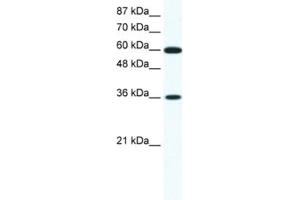 Western Blotting (WB) image for anti-Forkhead Box F1 (FOXF1) antibody (ABIN2460274) (FOXF1 antibody)