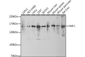 Western blot analysis of extracts of various cell lines, using SMC1 antibody (ABIN6132556, ABIN6148120, ABIN6148122 and ABIN6222780) at 1:1000 dilution. (SMC1A antibody  (AA 1-130))