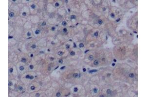 Detection of VEGF165 in Human Liver Tissue using Monoclonal Antibody to Vascular Endothelial Growth Factor 165 (VEGF165) (VEGF 165 (AA 28-191) antibody)