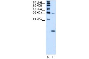 WB Suggested Anti-HBZ  Antibody Titration: 1. (HBZ antibody  (N-Term))