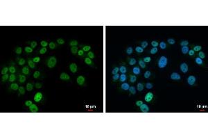 ICC/IF Image Islet 1 antibody detects Islet 1 protein at nucleus by immunofluorescent analysis. (ISL1 antibody)