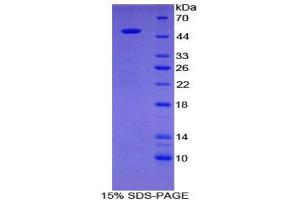 SDS-PAGE (SDS) image for Galactose 3-O-Sulfotransferase 1 (GAL3ST1) (AA 57-196) protein (His tag,GST tag) (ABIN2122887)