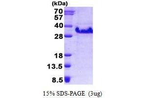 Image no. 1 for FXYD Domain Containing Ion Transport Regulator 5 (FXYD5) protein (His tag) (ABIN1098542)