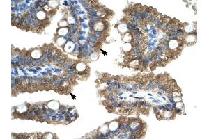 Human Intestine (CHRNA1 antibody  (C-Term))