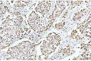 IHC analysis of Cyclophilin E/PPIE using anti-Cyclophilin E/PPIE antibody (ABIN7599242). (PPIE antibody  (AA 1-301))