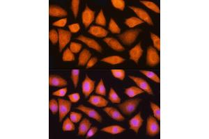 Immunofluorescence (IF) image for anti-Glia Maturation Factor, beta (GMFB) (AA 1-140) antibody (ABIN6141181)