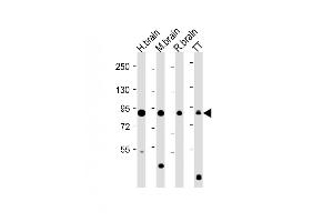 All lanes : Anti-hDCKL1- at 1:8000 dilution Lane 1: Human brain lysate Lane 2: Mouse brain lysate Lane 3: Rat brain lysate Lane 4: TT whole cell lysate Lysates/proteins at 20 μg per lane. (DCLK1 antibody  (AA 690-720))