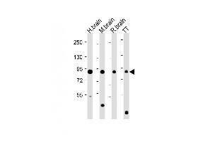 DCLK1 antibody  (AA 690-720)
