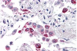 Human Lung: Formalin-Fixed, Paraffin-Embedded (FFPE) (EFHD1 antibody  (N-Term))