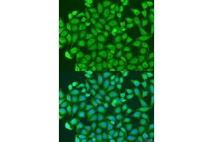 Immunofluorescence analysis of U2OS cells using PCDH antibody (ABIN6128584, ABIN6145301, ABIN6145302 and ABIN6220787) at dilution of 1:100. (PCDHA6 antibody  (AA 1-230))