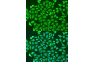 Immunofluorescence analysis of U2OS cells using PCDH antibody (ABIN6128584, ABIN6145301, ABIN6145302 and ABIN6220787) at dilution of 1:100.