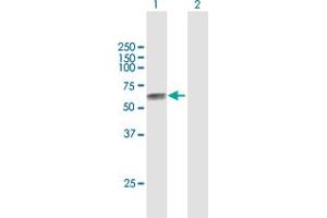 Western Blot analysis of TPBG expression in transfected 293T cell line by TPBG MaxPab polyclonal antibody. (TPBG antibody  (AA 1-420))