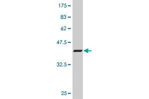 Western Blot detection against Immunogen (37. (ZEB2 antibody  (AA 1115-1214))