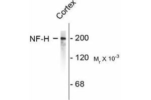 Image no. 1 for anti-Neurofilament, Heavy Polypeptide (NEFH) antibody (ABIN303930) (NEFH antibody)