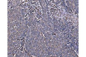 IHC analysis of Integrin Linked ILK using anti-Integrin Linked ILK antibody (ABIN7599411). (ILK antibody  (AA 1-452))