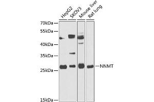 Western blot analysis of extracts of various cell lines, using NNMT antibody (ABIN6130587, ABIN6144695, ABIN6144697 and ABIN6218242) at 1:1000 dilution. (NNMT antibody  (AA 1-264))