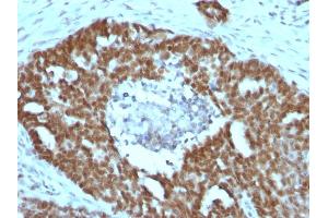 Immunohistochemistry (IHC) image for anti-Nucleolin (NCL) antibody (ABIN6940176)