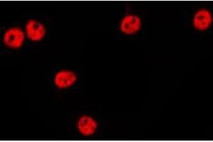 ABIN6275634 staining HepG2 by IF/ICC. (TCEAL1 antibody  (Internal Region))