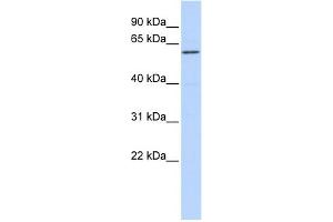 WB Suggested Anti-ZNF165 Antibody Titration:  0.