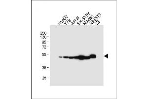 All lanes : Anti-NSE Antibody (Y25) at 1:4000 dilution Lane 1: HepG2 whole cell lysate Lane 2: Y79 whole cell lysate Lane 3: Jurkat whole cell lysate Lane 4: SH-SY5Y whole cell lysate Lane 5: Mouse brain tissue lysate Lane 6: NIH/3T3 whole cell lysate Lane 7: C6 whole cell lysate Lysates/proteins at 20 μg per lane. (ENO2/NSE antibody  (AA 6-32))