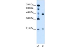 Western Blotting (WB) image for anti-Ubiquitin-Conjugating Enzyme E2E 2 (UBE2E2) antibody (ABIN2462697) (UBE2E2 antibody)