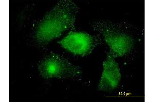 Immunofluorescence of monoclonal antibody to MARCKS on HeLa cell. (MARCKS antibody  (AA 2-65))