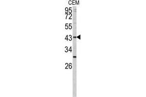 Western blot analysis of FUT1 antibody (Center) in CEM cell line lysates (35 µg/lane). (FUT1 antibody  (Middle Region))