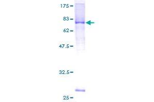 Image no. 1 for Leucine Rich Repeat Containing 17 (LRRC17) (AA 19-441) protein (GST tag) (ABIN1309746)
