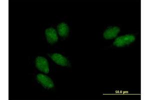 Immunofluorescence of purified MaxPab antibody to SSU72 on HeLa cell. (SSU72 antibody  (AA 1-194))