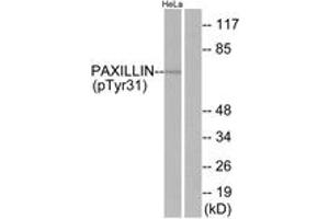 Western Blotting (WB) image for anti-Paxillin (PXN) (pTyr31) antibody (ABIN2888510) (Paxillin antibody  (pTyr31))