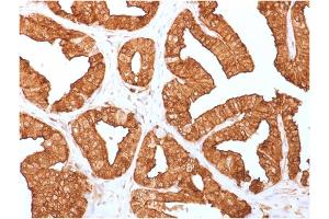 Formalin-fixed, paraffin-embedded human Prostate tissue stained with Annexin A1 Mouse Monoclonal Antibody (ANXA1/1671). (Annexin a1 antibody)