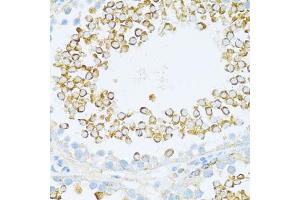 Immunohistochemistry of paraffin-embedded rat testis using DVL1 antibody (ABIN7266796) at dilution of 1:100 (40x lens). (DVL1 antibody  (AA 510-640))