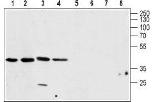 Western blot analysis of rat brain (lanes 1 and 5), mouse brain (lanes 2 and 6), human U-87 MG brain glioblastoma cell line (lanes 3 and 7) and rat C6  brain glioma cell line (lanes 4 and 8) lysates: - 1-4. (CALHM1 antibody  (C-Term, Intracellular))