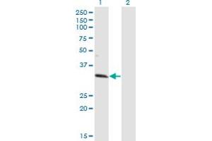 Western Blot analysis of ZNF101 expression in transfected 293T cell line by ZNF101 monoclonal antibody (M01), clone 2D5. (ZNF101 antibody  (AA 112-201))